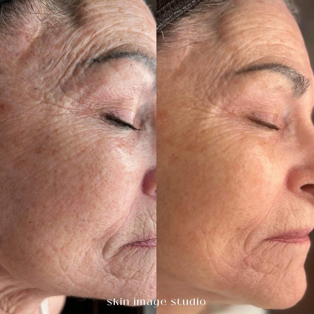 Advanced Skincare Treatments Fort Worth - Texas - Fort Worth ID1600018