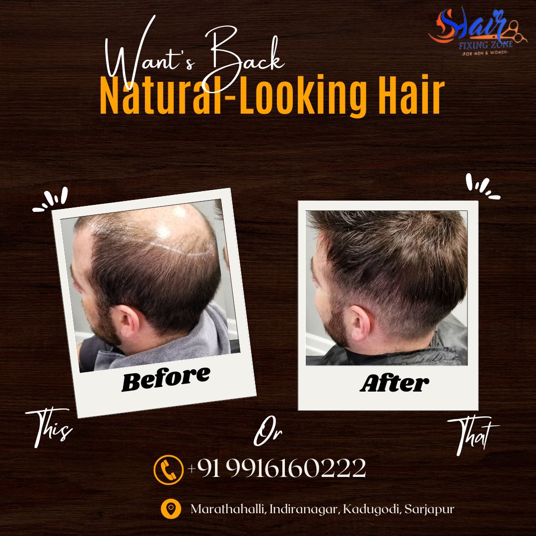 Effortless Hair Restoration Fullness and Volume - Karnataka - Bangalore ID1552829