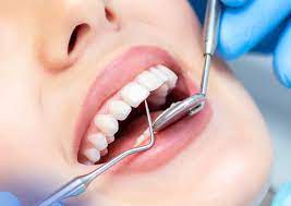 !Avoid mouthwash TOP dentists warn - California - Chula Vista ID1541184