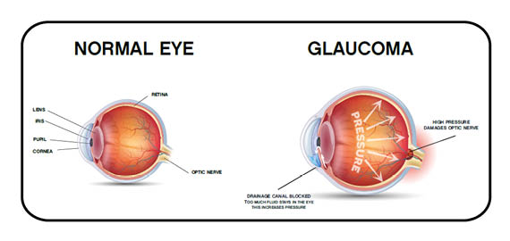 Experienced The Best Glaucoma Specialist in Bardhaman - West Bengal - Hooghly ID1609265
