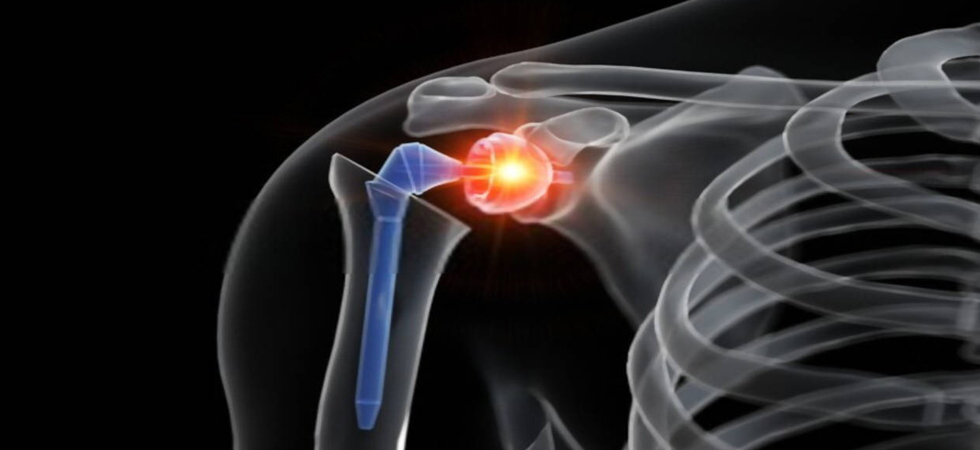 Best Orthopedic Surgeon near me  Best Orthopedic Doctor nea - Karnataka - Bangalore ID1593078