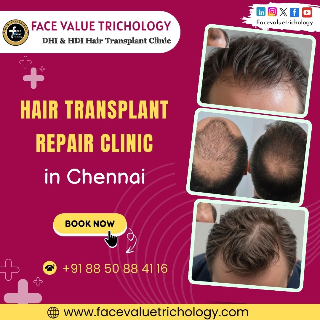Best Hair Transplant Clinic in Chennai - Tamil Nadu - Chennai ID1594167