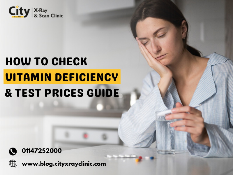 How to Check Vitamin Deficiency and Test Prices Guide - Delhi - Delhi ID1607803