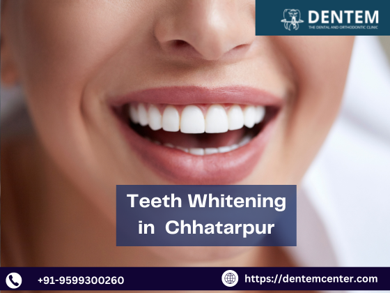 Teeth Whitening in Chhatarpur  Dentem Center - Delhi - Delhi ID1559751