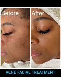 Natural Skin Renewal Method Leaves Dermatologists Speechless - West Virginia - Berkeley Springs ID1518057 3