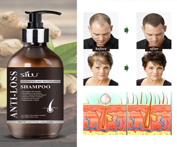 Natural Shampoo - California - Costa Mesa ID1541995