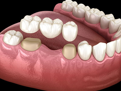 Gorakhpur Gleam Dr Rashids Brilliance in Dentistry - Uttar Pradesh - Gorakhpur ID1542969 3
