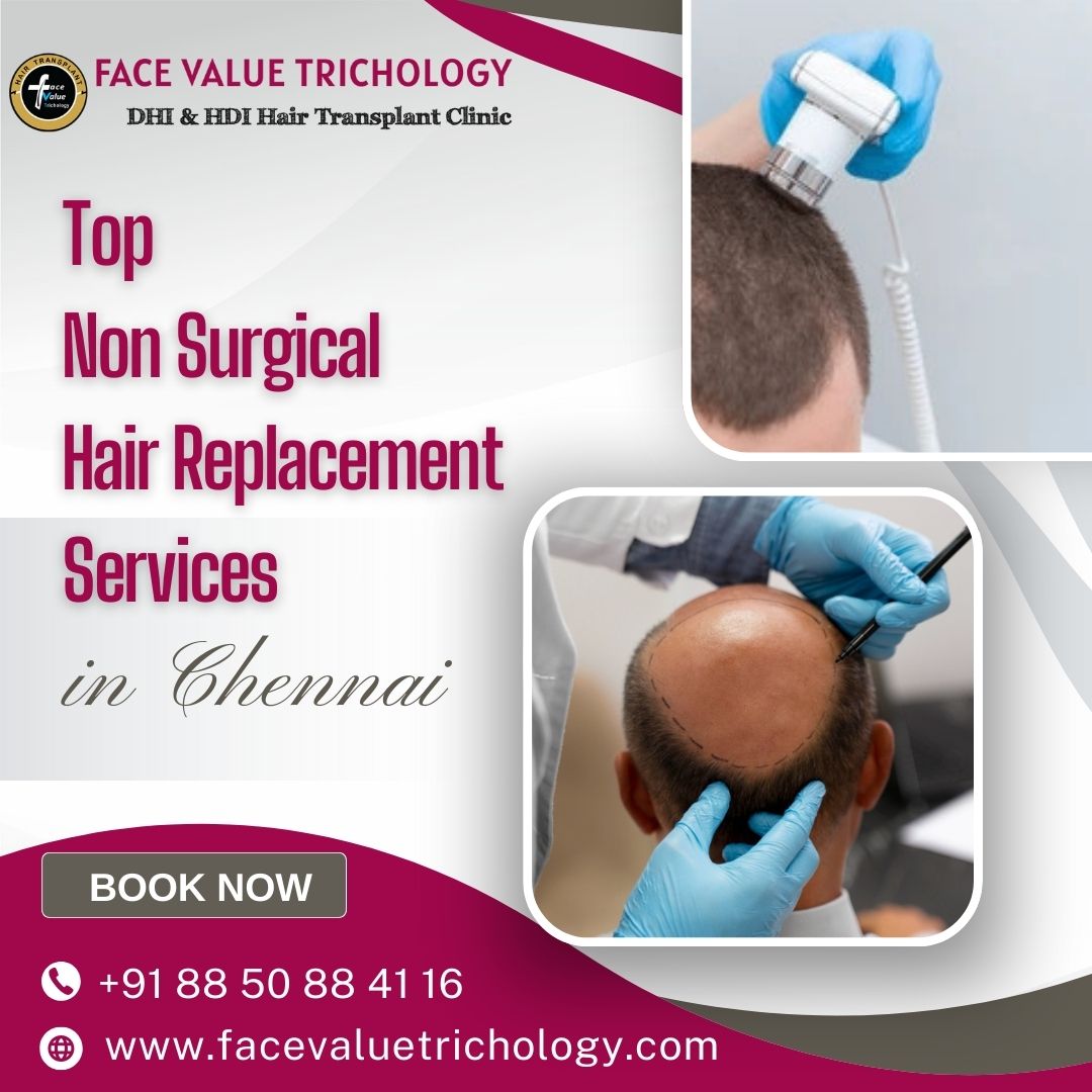 Top Hair Replacement Services in Chennai - Tamil Nadu - Chennai ID1596099 2