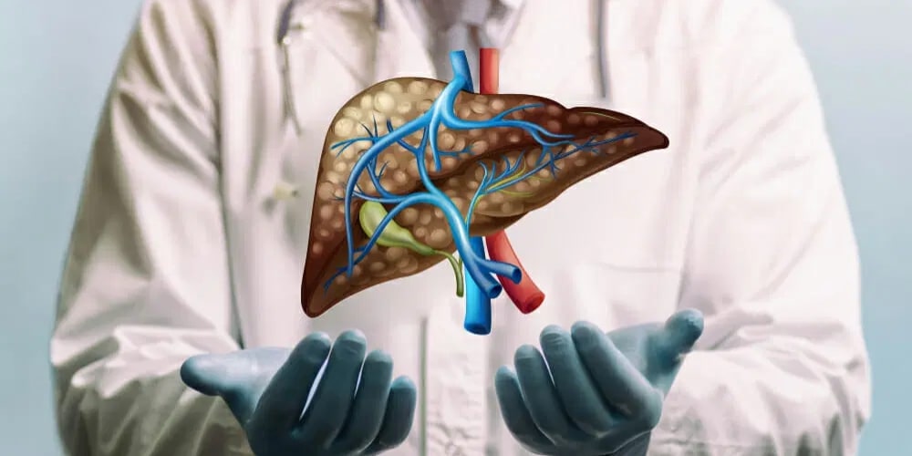 Fatty Liver Treatment in Gurgaon  Gutwell Clinic - Haryana - Gurgaon ID1609640