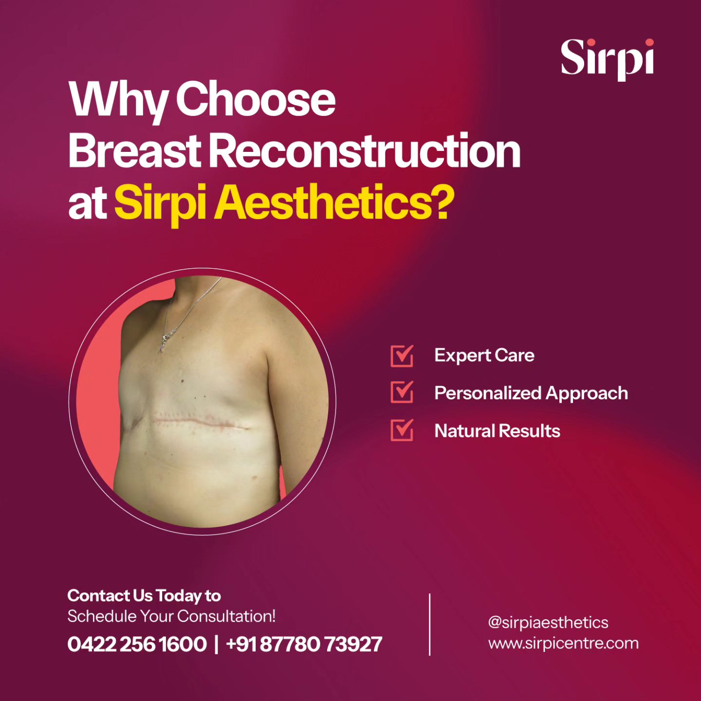 Best Cosmetic Surgery Centre in Coimbatore  Sirpi Centre - Tamil Nadu - Coimbatore ID1549995 3