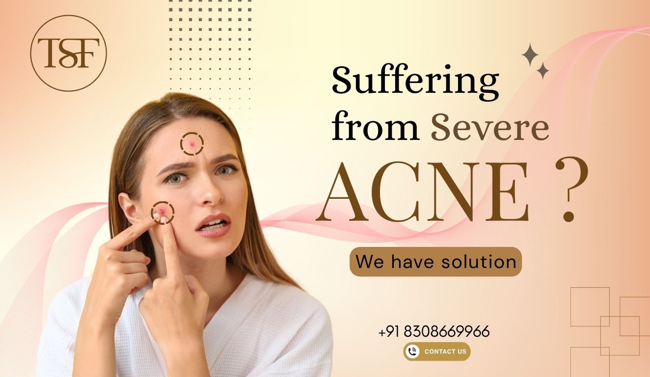 Best Skin Specialist  Dermatologist in Pune  The Skin Fi - Maharashtra - Pune ID1620456