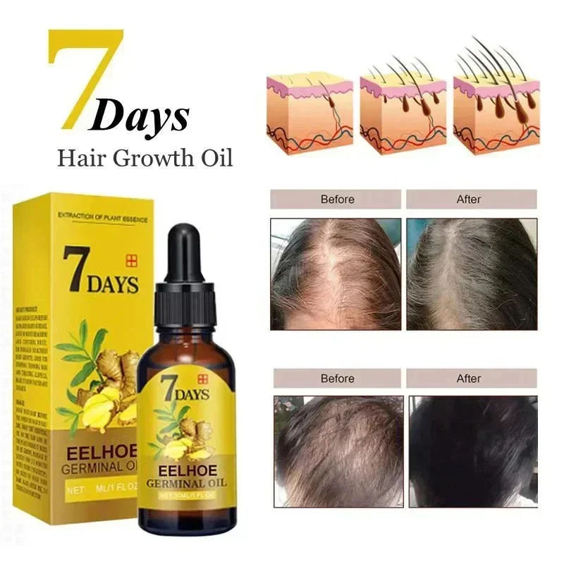 7 Days Eelhoe Germinal Oil  Fast Hair Growth  Nourishmen - California - Los Angeles ID1619675 3