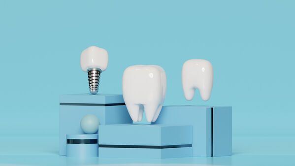 Affordable Dental Implant Clinic in Newtown - West Bengal - Kolkata ID1613554