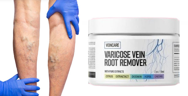 What makes VeinCare Root Remover different from other creams - California - Los Angeles ID1610177