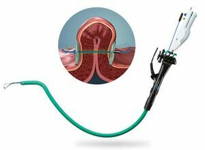 Leading Bariatric Endoscopy Treatment in Ludhiana  Dr Ni - Punjab - Ludhiana ID1604988