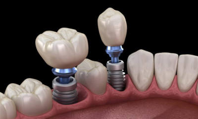 McClane Dentistry - Florida - West Palm Beach ID1601383 4