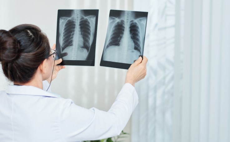 How Pulmonologist in Etawah Manages Lung Infections  Swadha - Uttar Pradesh - Kanpur ID1612443