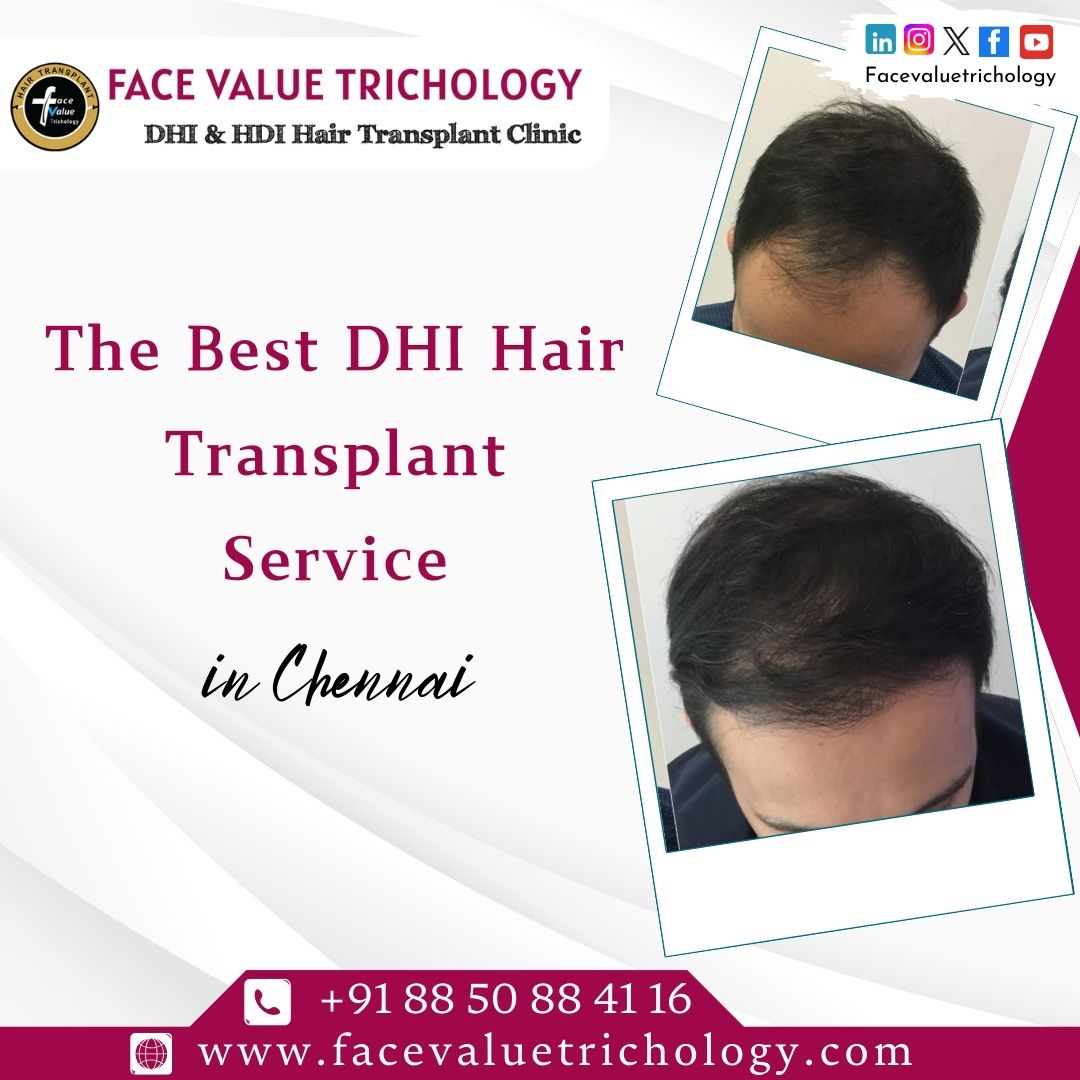 DHI Hair Transplant Clinic in Chennai - Tamil Nadu - Chennai ID1595980