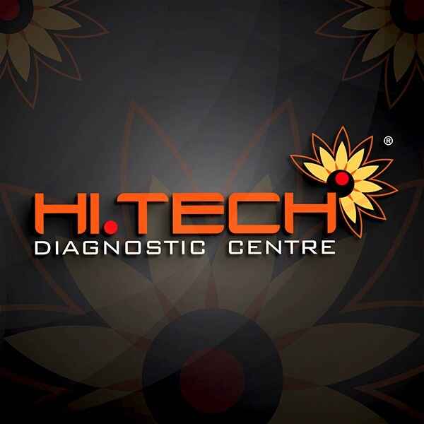 Looking for the Best Labs in Kochi? Heres Why HiTech Dia - Kerala - Kochi ID1618420
