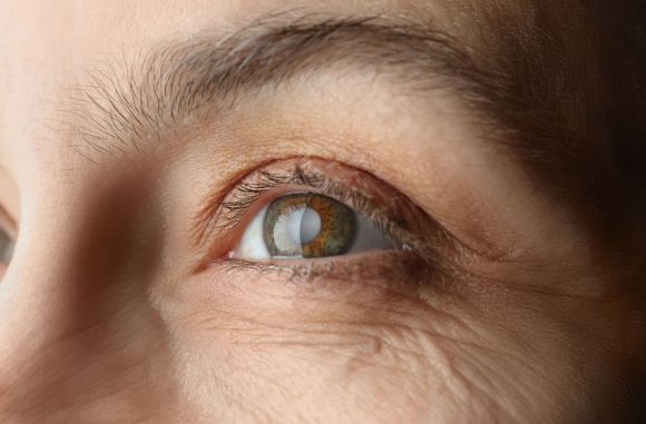 Effective Glaucoma Treatment in Bardhaman by Expert Eye Spec - West Bengal - Kolkata ID1608891