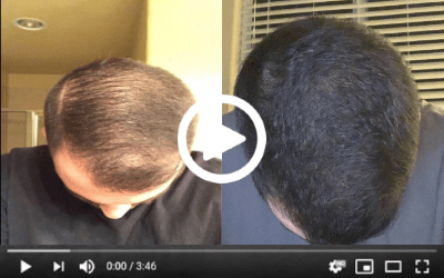 Hair follicle rejuvenation trick in 15 minutes? - Alabama - Huntsville ID1519898 2