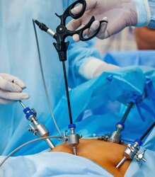 Expert Laparoscopic Surgeon in Ahmedabad  Dr Jigar Patel - Gujarat - Ahmedabad ID1593974
