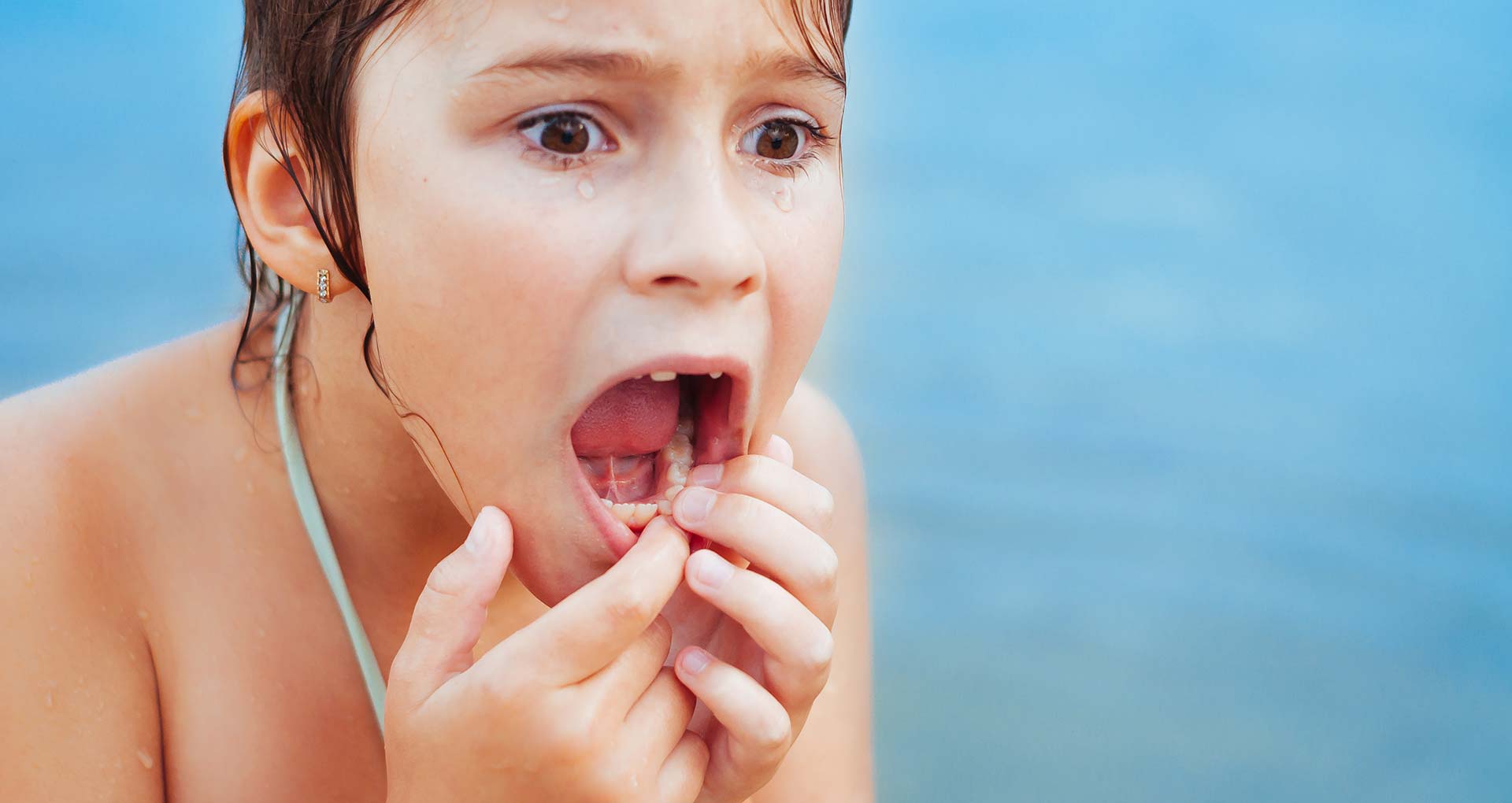 Wisdom Teeth Removal  Hygienic and professional dental care - Arizona - Phoenix ID1604368