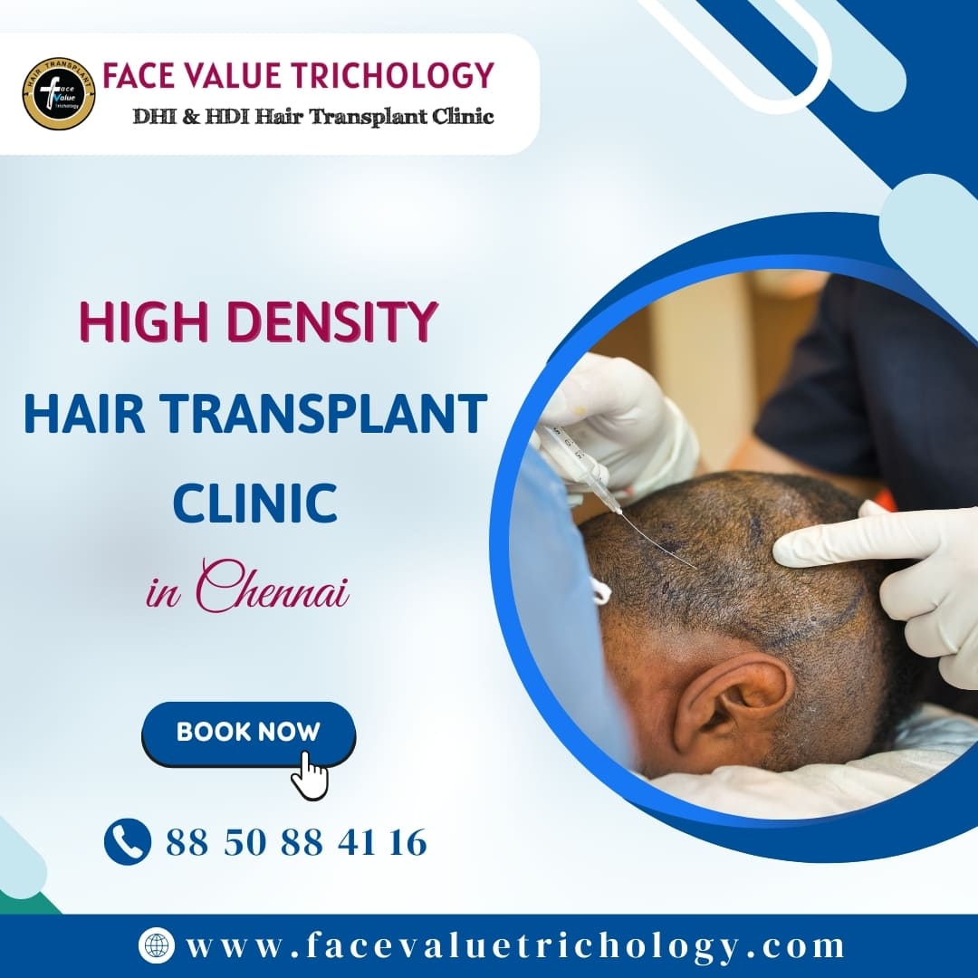 Hair Transplant Surgery Doctors In Chennai - Tamil Nadu - Chennai ID1597820 2