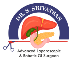 Dr Srivatsan Gurumurthy  Robotic Hernia  Laparoscopic Gal - Tamil Nadu - Chennai ID1538403