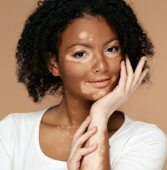  Botox treatment near me  vitiligo treatment  Dermatologis - Karnataka - Bangalore ID1594273