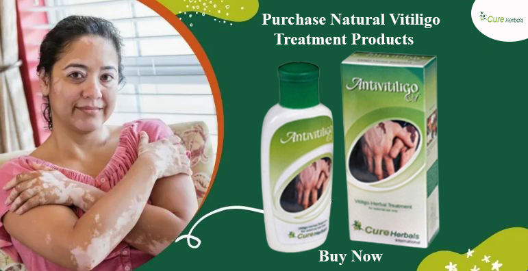 Order Herbal Remedies for Vitiligo Online - Alaska - Anchorage ID1600009