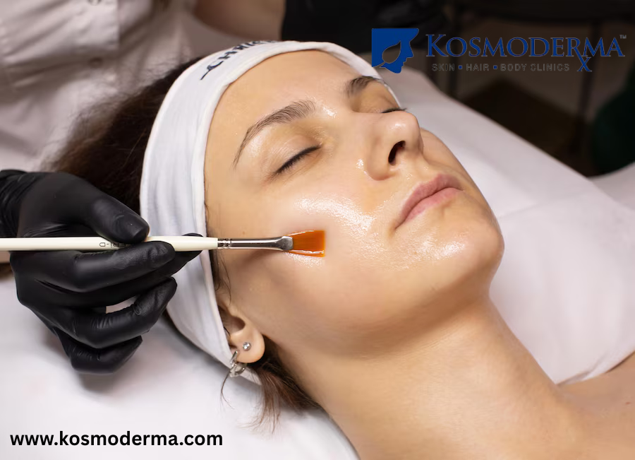 Chemical Peel for Skin Lightening and Pigmentation in Bangal - Karnataka - Bangalore ID1603117