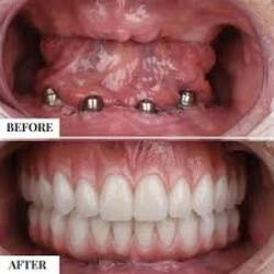 Best Keyhole Dental Surgery in Kolkata - West Bengal - Kolkata ID1593173