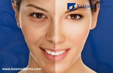 Skin Lightening Injections in Bangalore Brighten Your Glow - Karnataka - Bangalore ID1604140