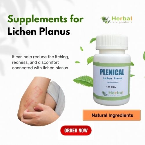 Herbal Supplement for Lichen Planus - Delhi - Delhi ID1612097