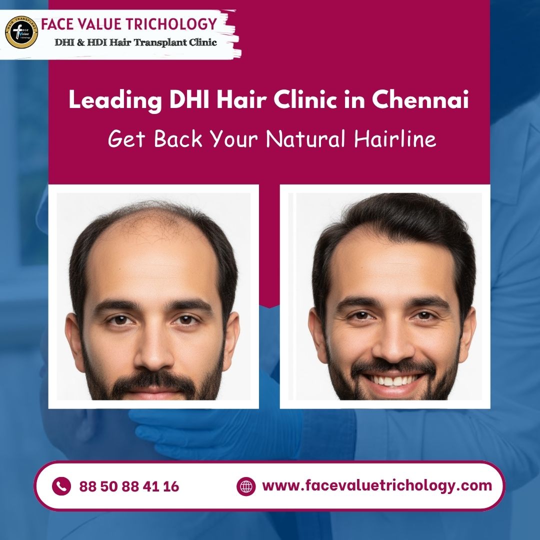 Best Direct Hair Implantation Services in Madurai - Tamil Nadu - Chennai ID1617285