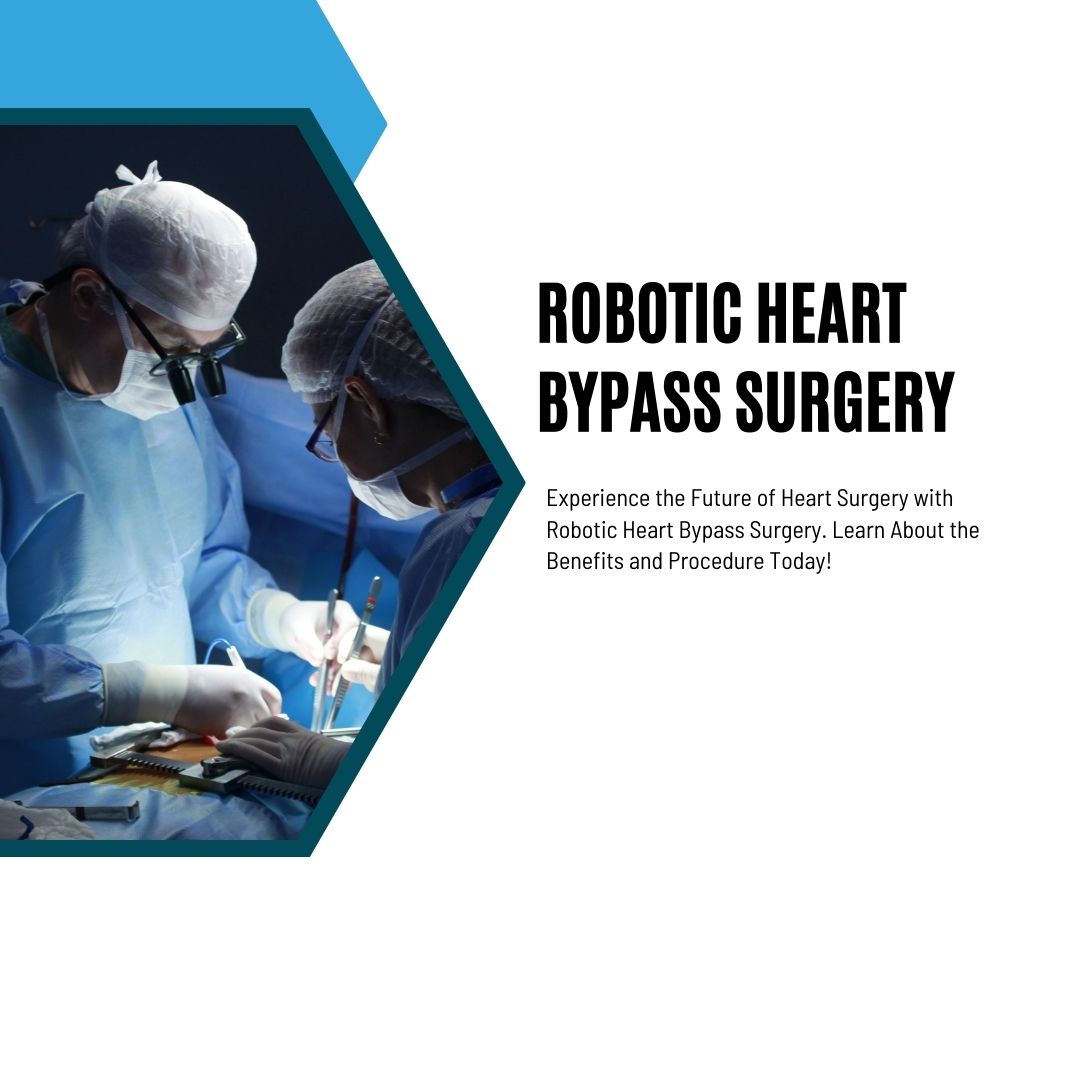 Robotic Heart Bypass Surgery - Karnataka - Bangalore ID1556361