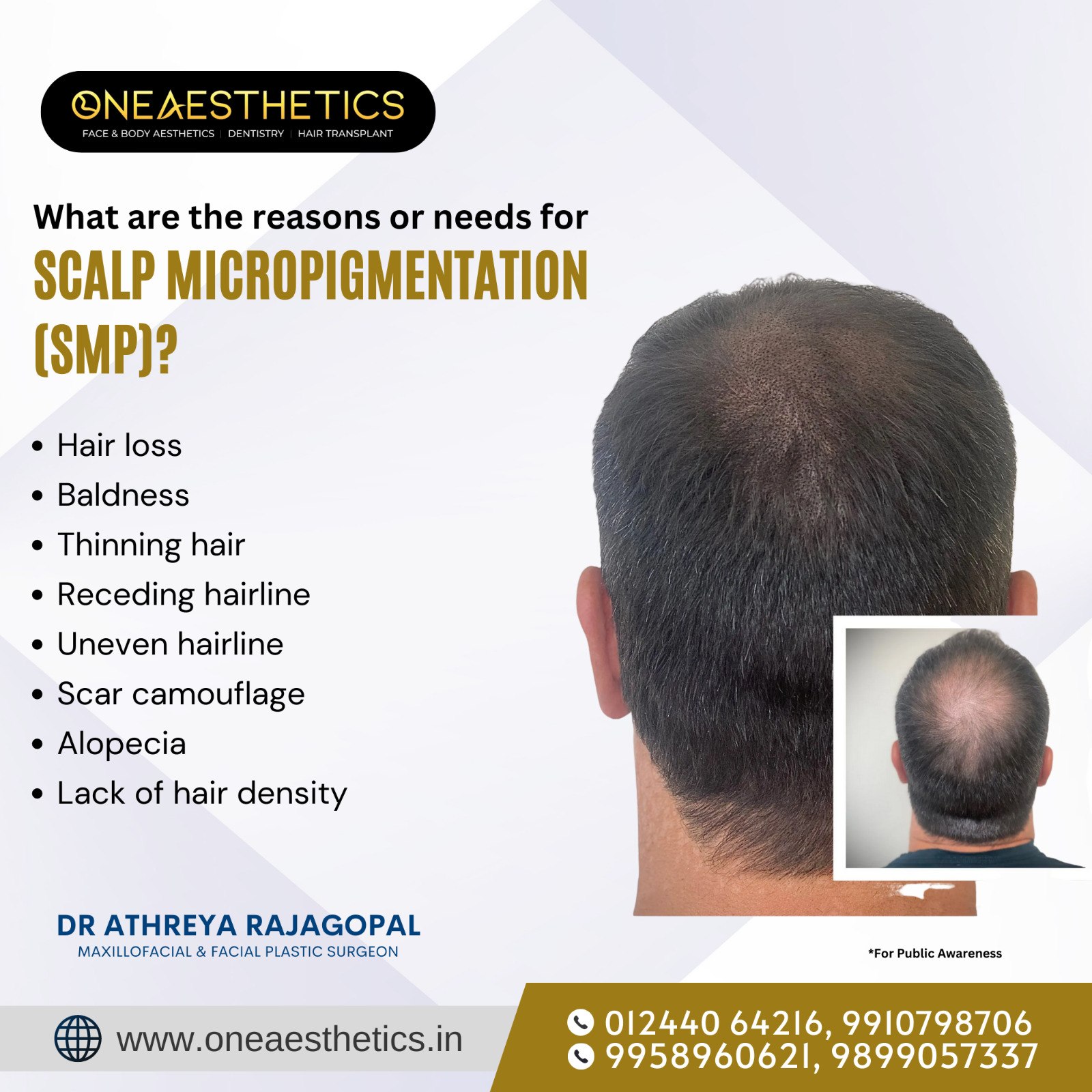 Best Hair Transplant Surgeon In Gurgaon - Chandigarh - Chandigarh ID1585512