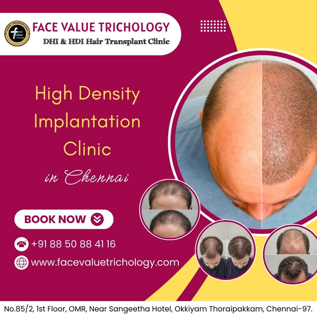 Best Hair Transplant Clinic in Chennai - Tamil Nadu - Chennai ID1594167 2
