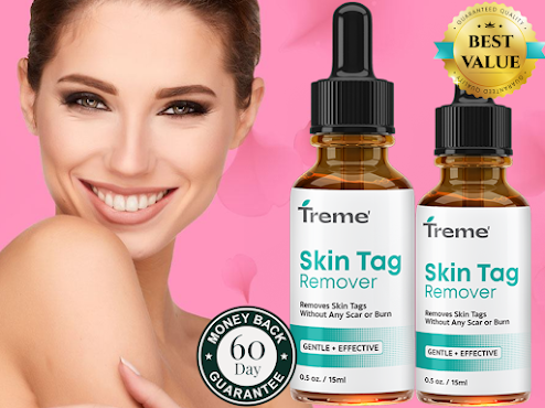 How Does Treme Skin Tag Remover Work? - Alabama - Birmingham ID1591208