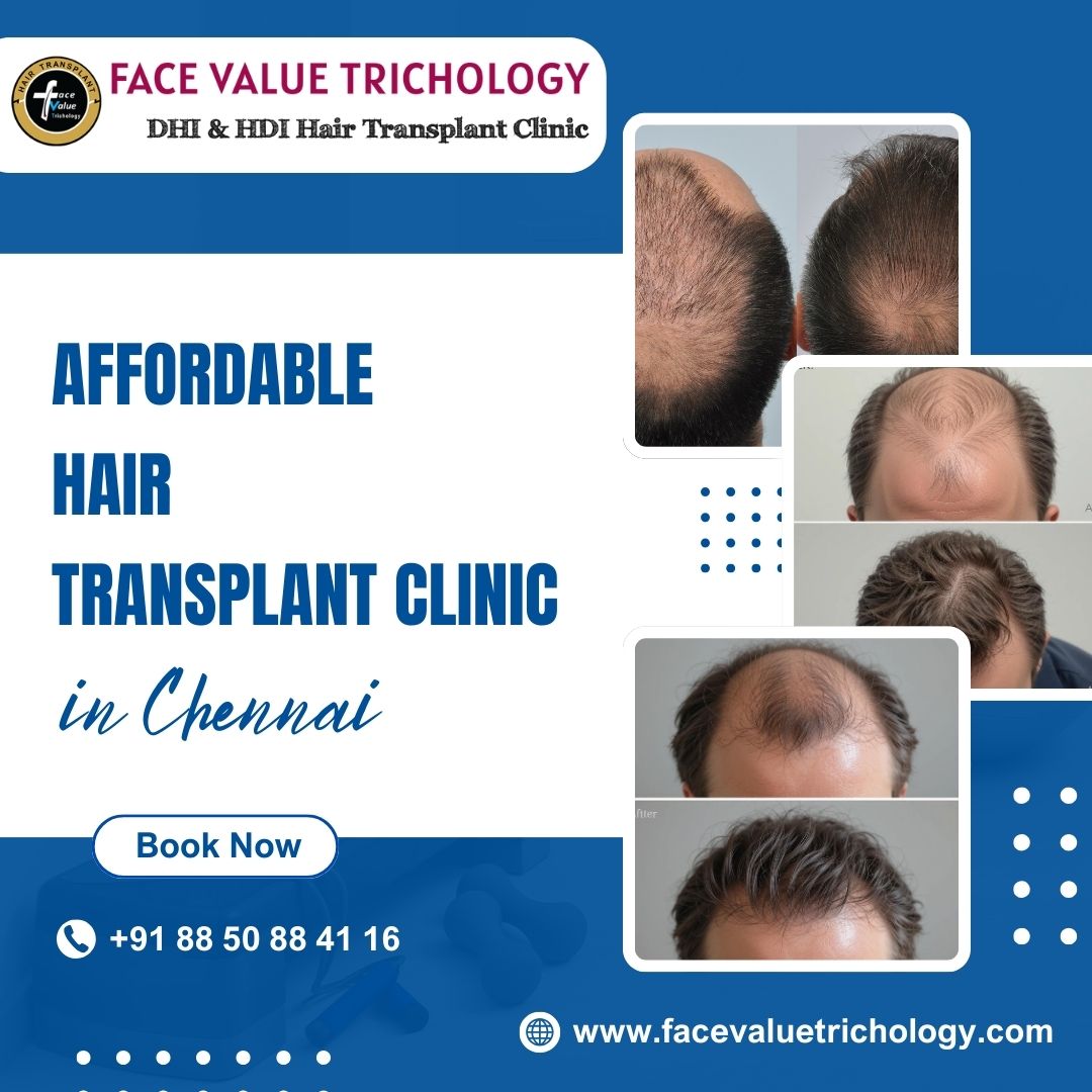 Best Hair Restoration Clinic in  Chennai - Tamil Nadu - Chennai ID1594457