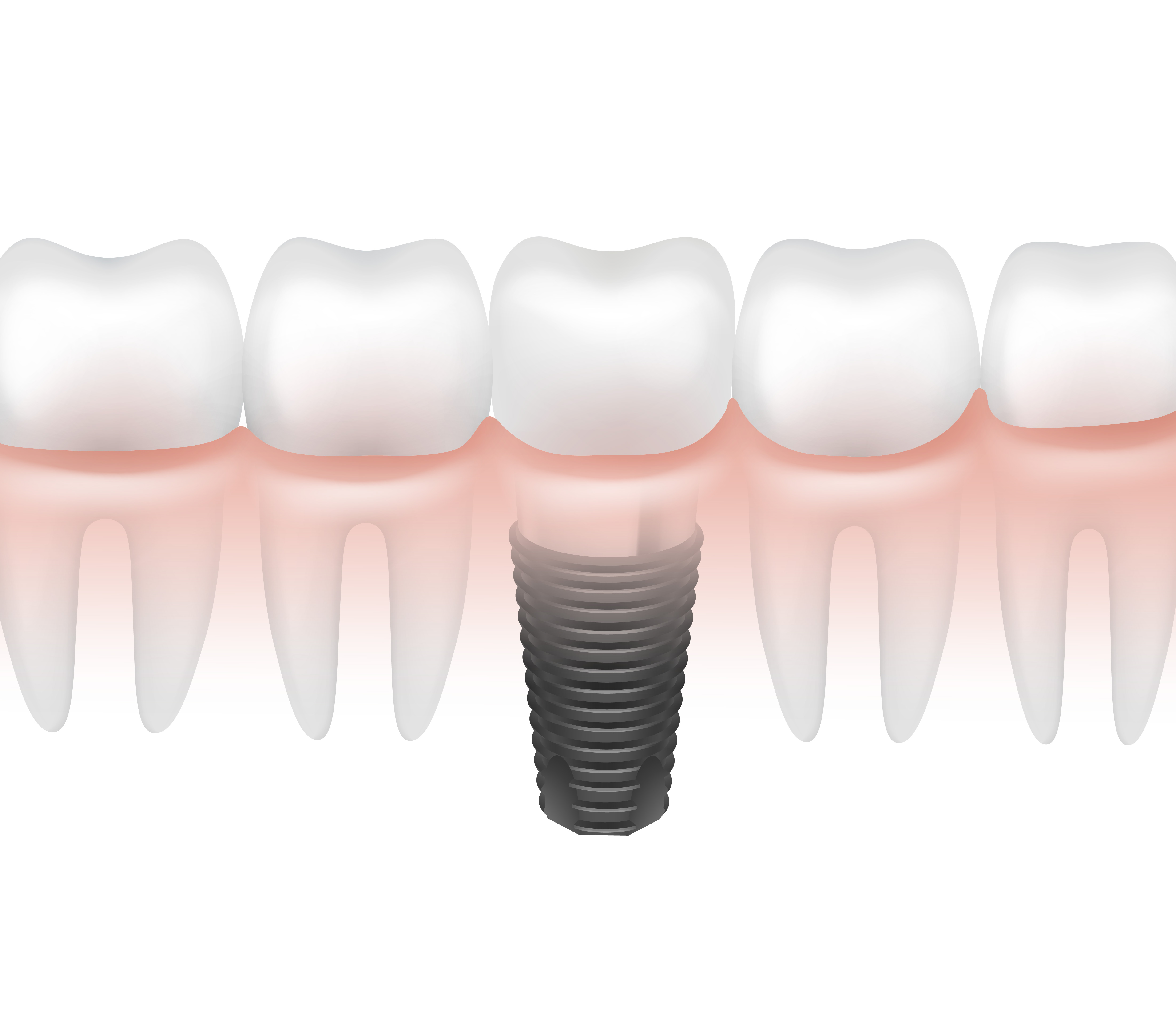 Exceptional Dentist in Austin - Texas - Austin ID1587298