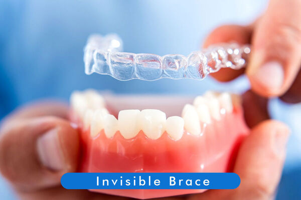 Invisible Braces Treatment in Newtown - West Bengal - Kolkata ID1613186