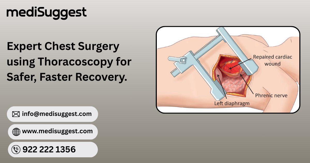 Thoracoscopy surgery - Maharashtra - Mumbai ID1612159