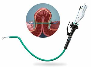 Best Bariatric Endoscopy Treatment in Ludhiana - Punjab - Ludhiana ID1595438