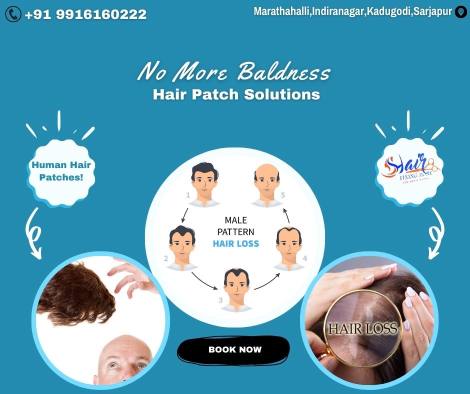Seamless Coverage Human Hair Patch Solutions - Karnataka - Bangalore ID1550917