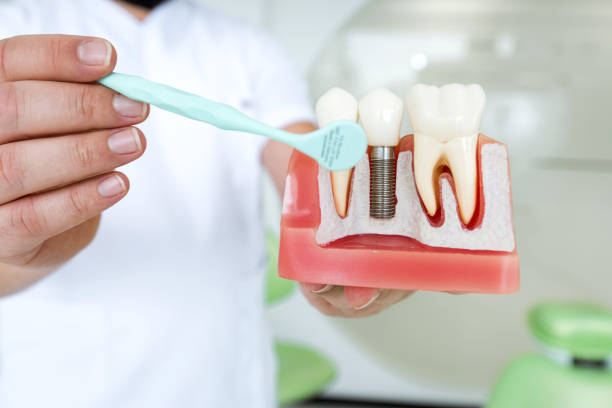 Best Dental Implant Clinic in Kolkata - West Bengal - Kolkata ID1591244