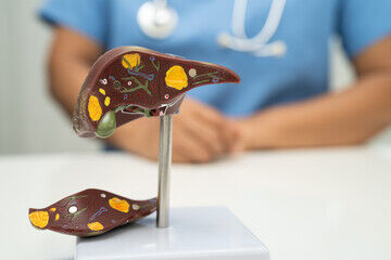 Top Chronic Liver Specialists in Ludhiana for Expert Care - Punjab - Ludhiana ID1613557