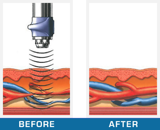 Treatment Options For Erectile Dysfunction - California - San Diego ID1587932