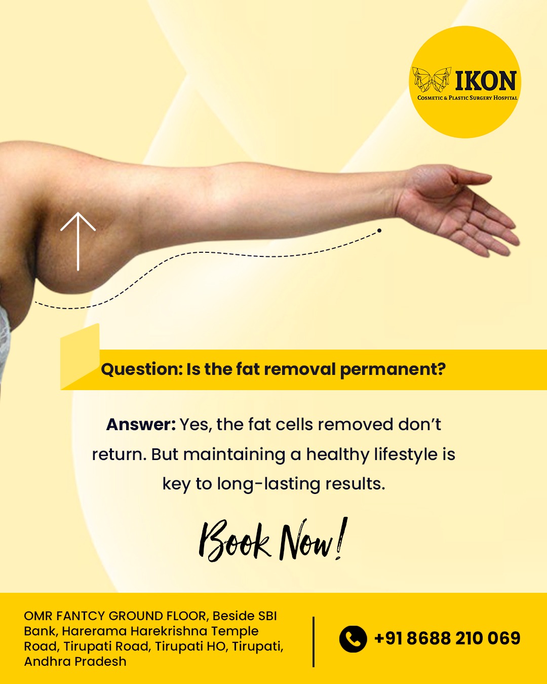 Liposuction Treatment In Tirupati - Andhra Pradesh - Tirupati ID1612806